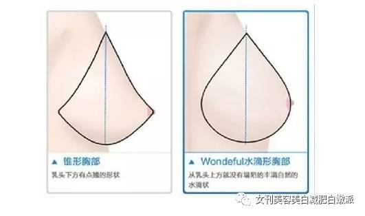 马伊璃的胸下垂,还有救吗?