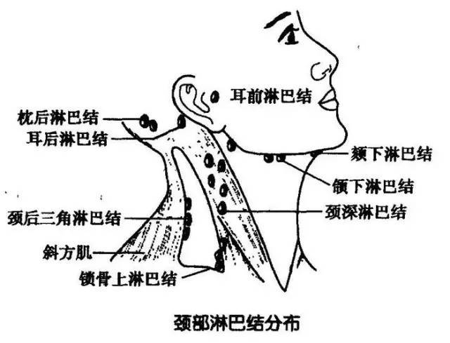 淋巴堵塞会致癌!千万要重视!