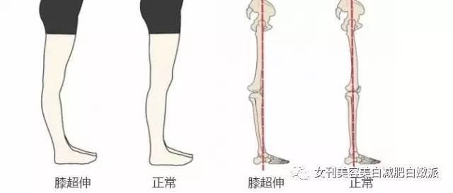 郑爽的漫画腿被吹上天?可再美也是畸形的