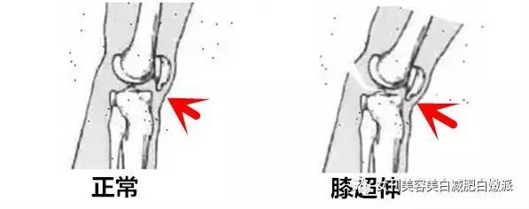 郑爽的漫画腿被吹上天?可再美也是畸形的