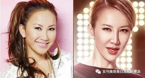 丽颖娘亲,和杨幂抢夫君,却因为离奇的鼻子大