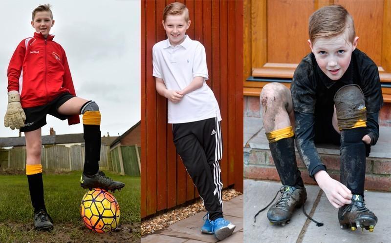 励志!12岁独臂独腿男孩成足球队长