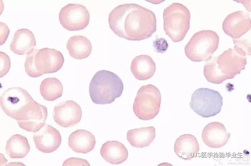 红细胞生理及红细胞一般检验