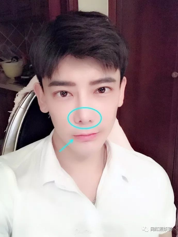 鼻孔一大一小真的只是拍照角度的问题吗?
