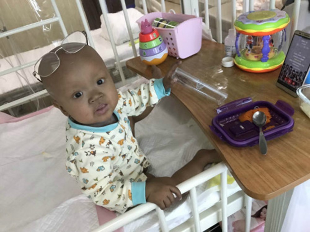 经历了什么?白血病幼童治疗3个月 皮肤变黝黑