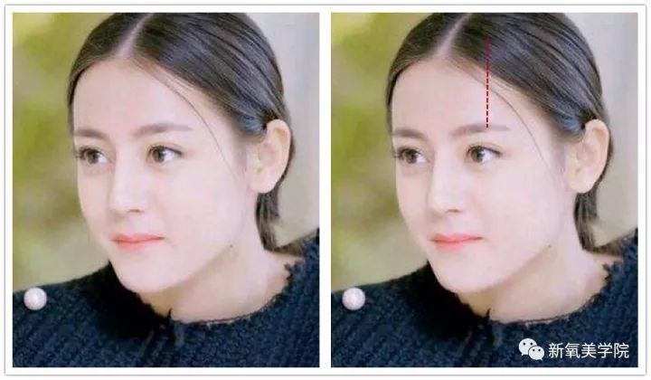 女星为什么不惜变寿星也要拼命填额头