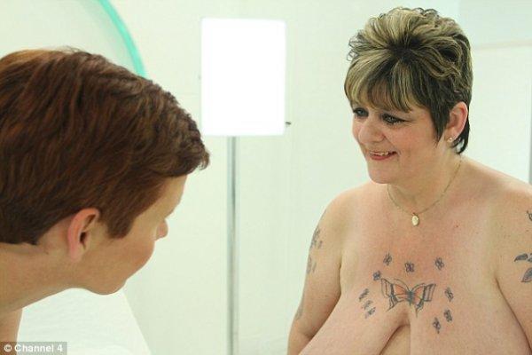 51岁女子拥40L罩杯巨胸