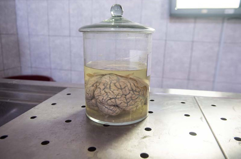 这些大脑都浸泡在福尔马林溶液中,学生可以看到大脑的各个结构,也有