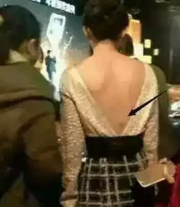 明星真的好辛苦,太拼了!郑爽腰痛发作打电话求救,表情