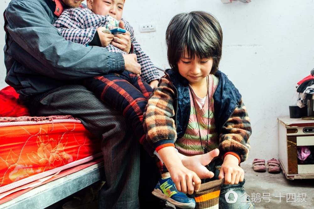 5岁弟弟患怪病龙虾脚,8岁姐姐撑起半个家