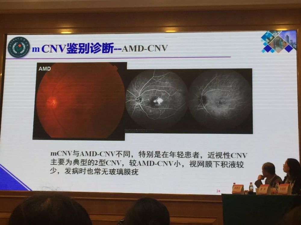 南医科大学附属医院吕红彬教授:病理性近视引