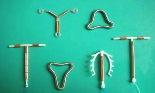 最好的避孕措施是带环吗?关于节育环你不得不