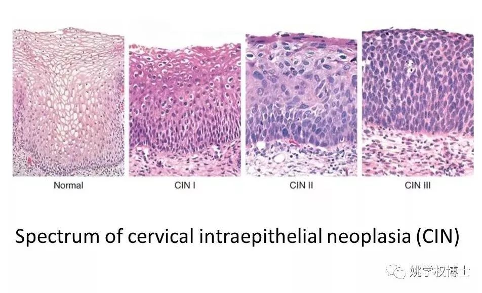 肿瘤微创手术之后,留下的深度思考