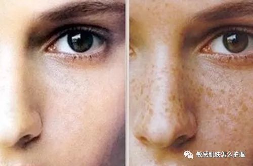 涂涂护肤老师:茶叶水洗脸祛斑,靠谱吗?