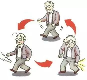 盘突出并发黄韧带肥厚,引发了你的椎管狭窄!