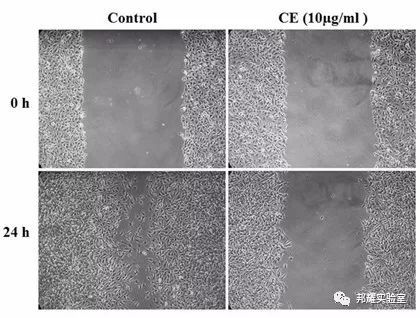 细胞迁移必备技能--划痕实验
