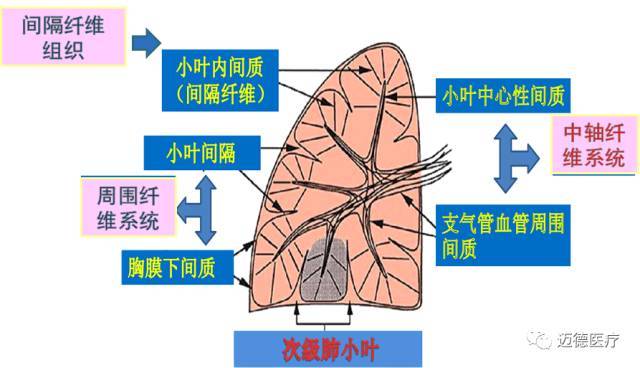 肺间质改变的基本ct表现