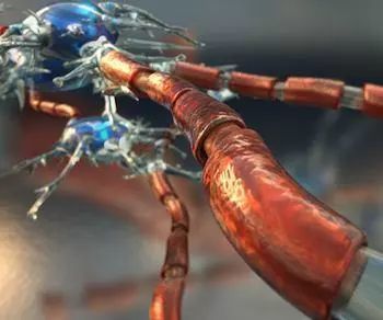 脑子瓦塔了-代谢性脑病概述