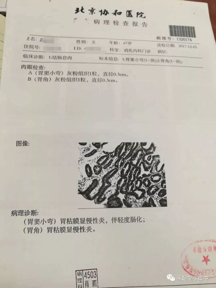 窦永起验案--逆转肠化生