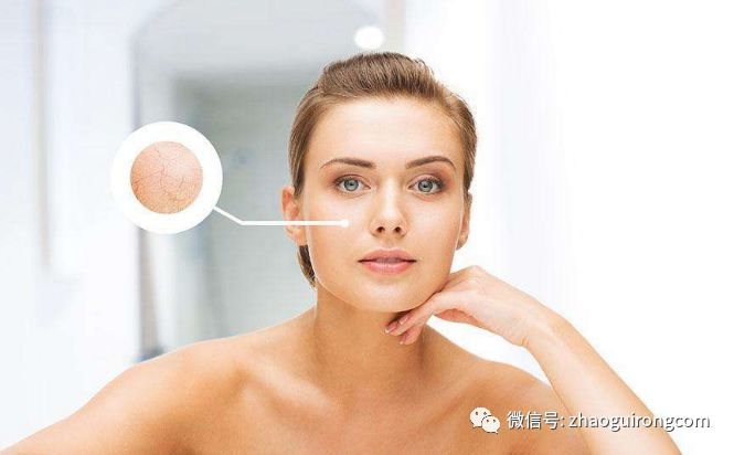 化妆品皮炎\/敏感性肌肤,来自吹弹可破的诡计