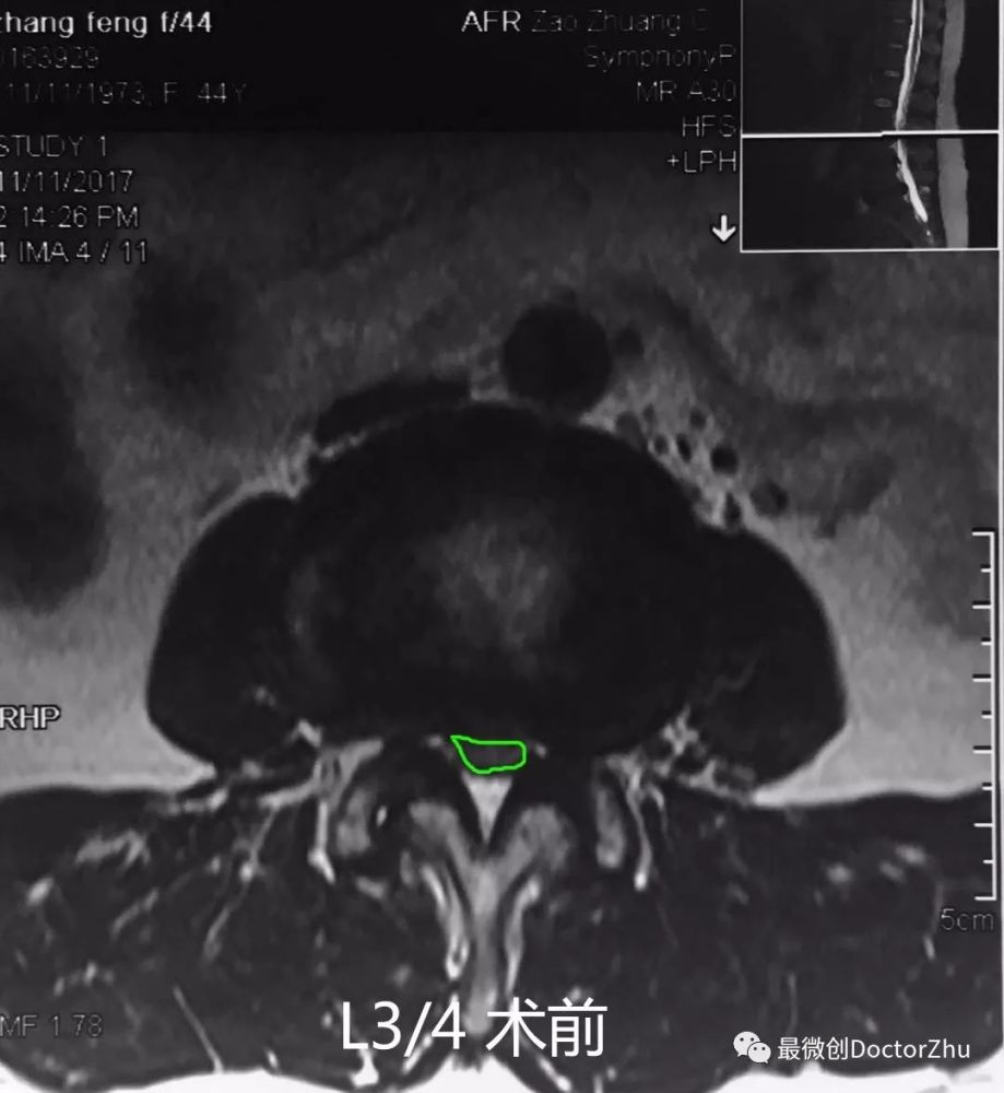 过则勿惮改-正确的对待与处理医疗行为中的过