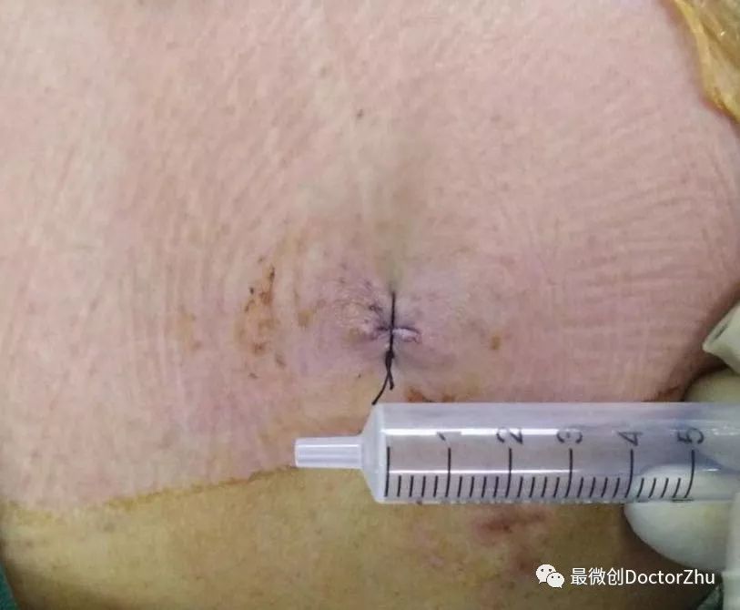 过则勿惮改-正确的对待与处理医疗行为中的过