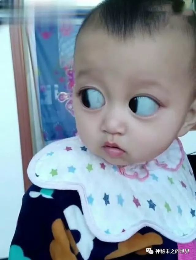 女子怀孕期间天天吃黑葡萄,结果孩子出生那刻