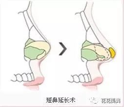 深度解剖鼻子类型,测试你属于哪种鼻型?