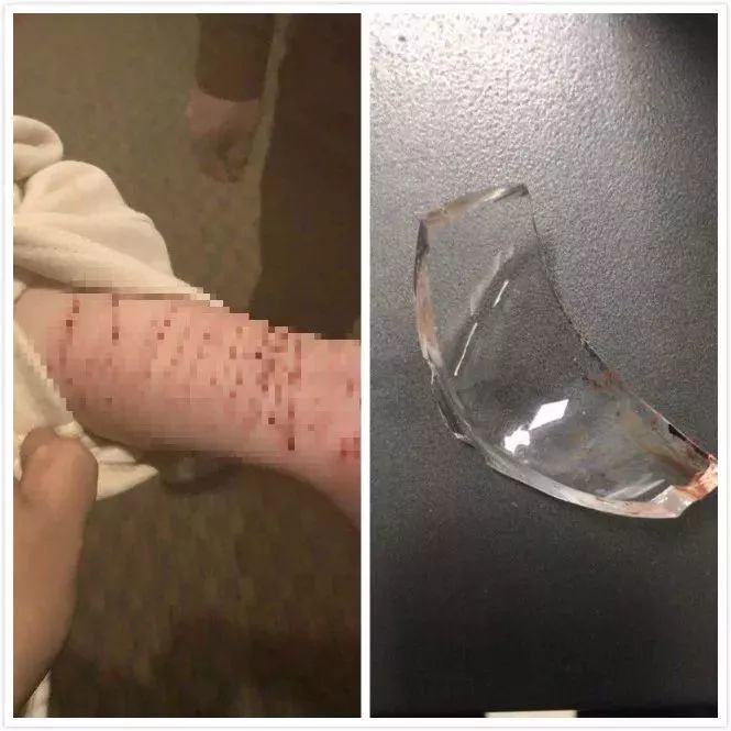 深圳一女子将手腕割得血淋淋发朋友圈 警方紧急找她