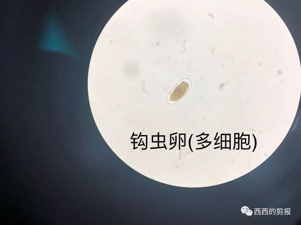 还有个斯氏狸殖吸虫的第一中间宿主——拟钉螺,没图,超级无敌小,眼镜