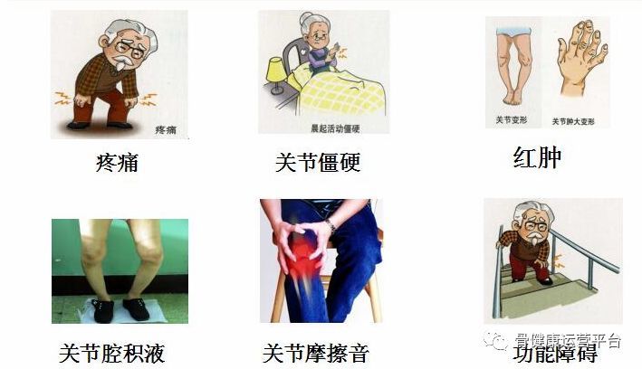 关节疼痛,关节肿胀,活动受限或晨僵,响声或摩擦音,关节畸形和功能受限