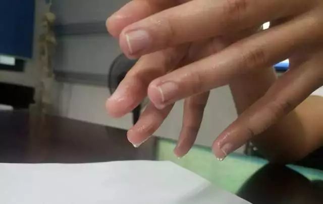 深圳女子去公安局 3臺機器都采集不到她的指紋