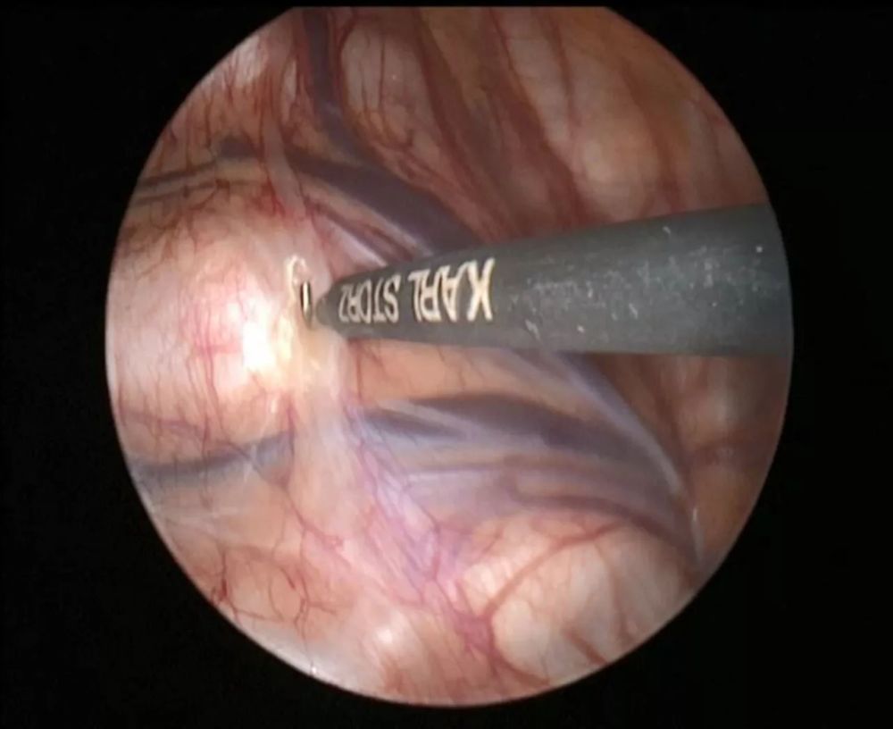 深圳女子去公安局 3臺機器都采集不到她的指紋