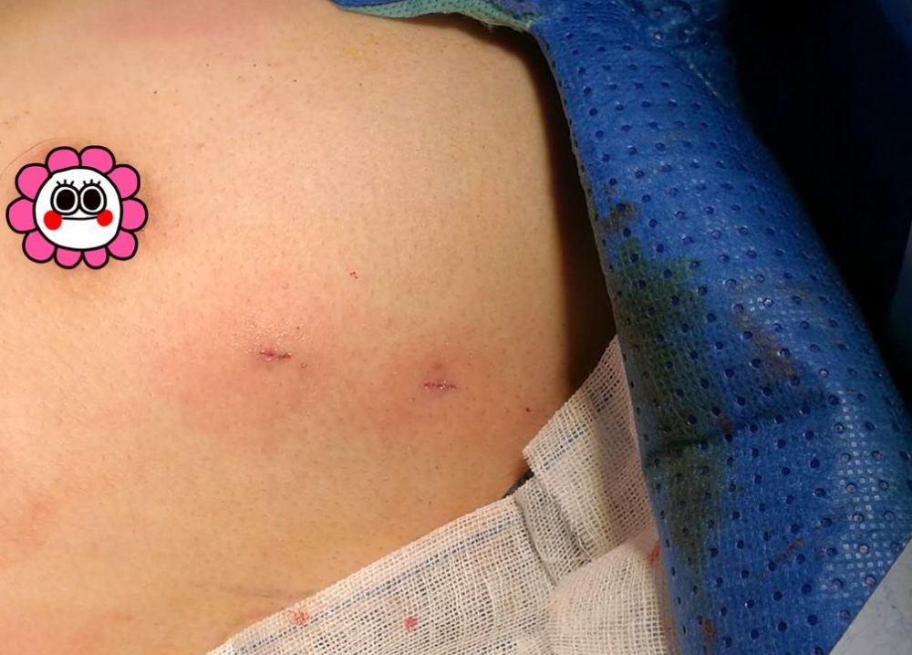 深圳女子去公安局 3臺機器都采集不到她的指紋