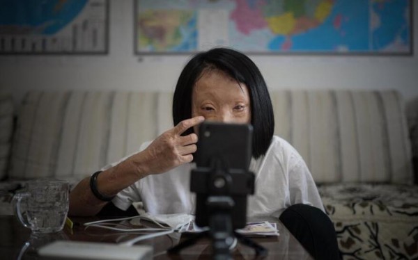 漂亮女孩被男友泼硫酸致脸部毁容,身残志坚的