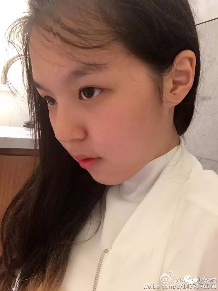 出道前的欧阳娜娜是个龅牙妹?