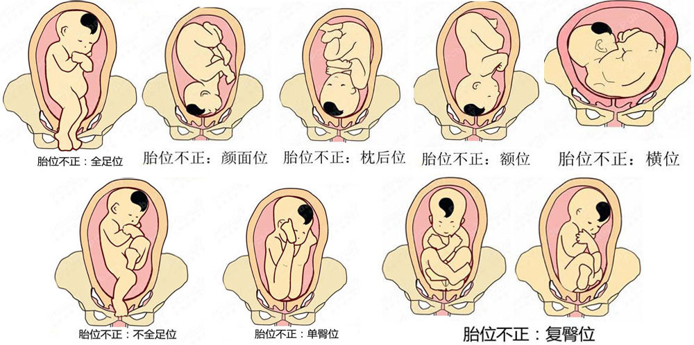 宝宝胎位有哪些 看看你的宝宝是什么胎位
