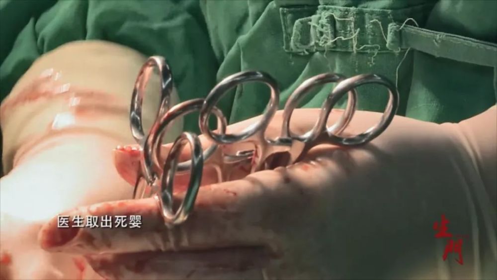 最真实的妇产科纪录片,全程揪着心看完