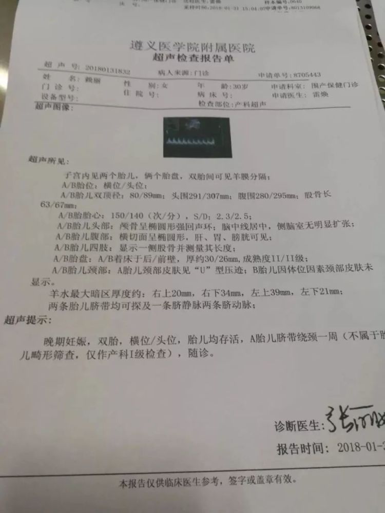 仁怀一双胞胎孕妇临产被下病危通知书,急需o型血!