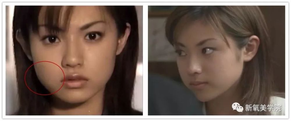 她是日本最甜的女明星 16岁美炸天 30岁整残 35岁又美回巅峰 韩国41岁女明星整容成20岁 梦贤微生活