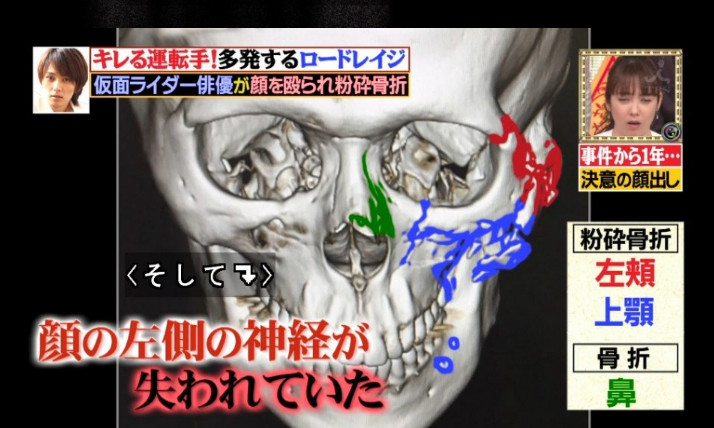 正义英雄不会被摧毁！基佬剑首次在节目露脸