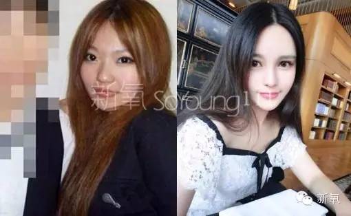 整成Angelababy的网红们，简直傻傻分不清