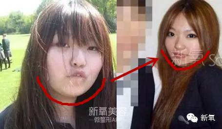 整成Angelababy的网红们，简直傻傻分不清