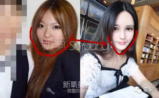 整成Angelababy的网红们，简直傻傻分不清
