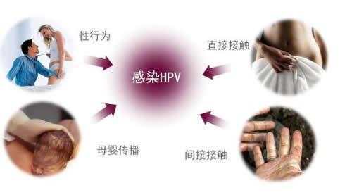 hpv病毒的传染途径,你还是应该清楚的