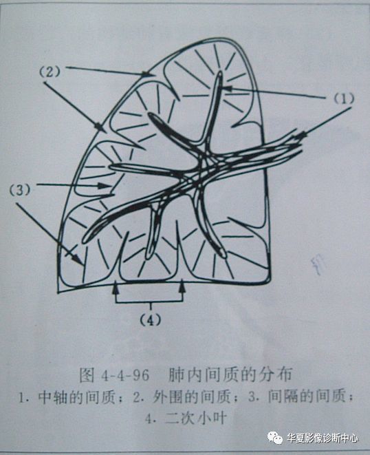 肺小叶解剖示意图