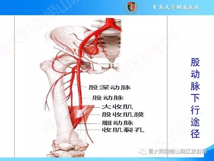 下肢动脉的解剖