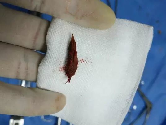 喝了一口奶奶递来的矿泉水,广东1岁幼童不幸