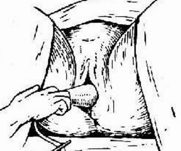 女性在顺产的时候,宝宝是怎么从那么小的地方