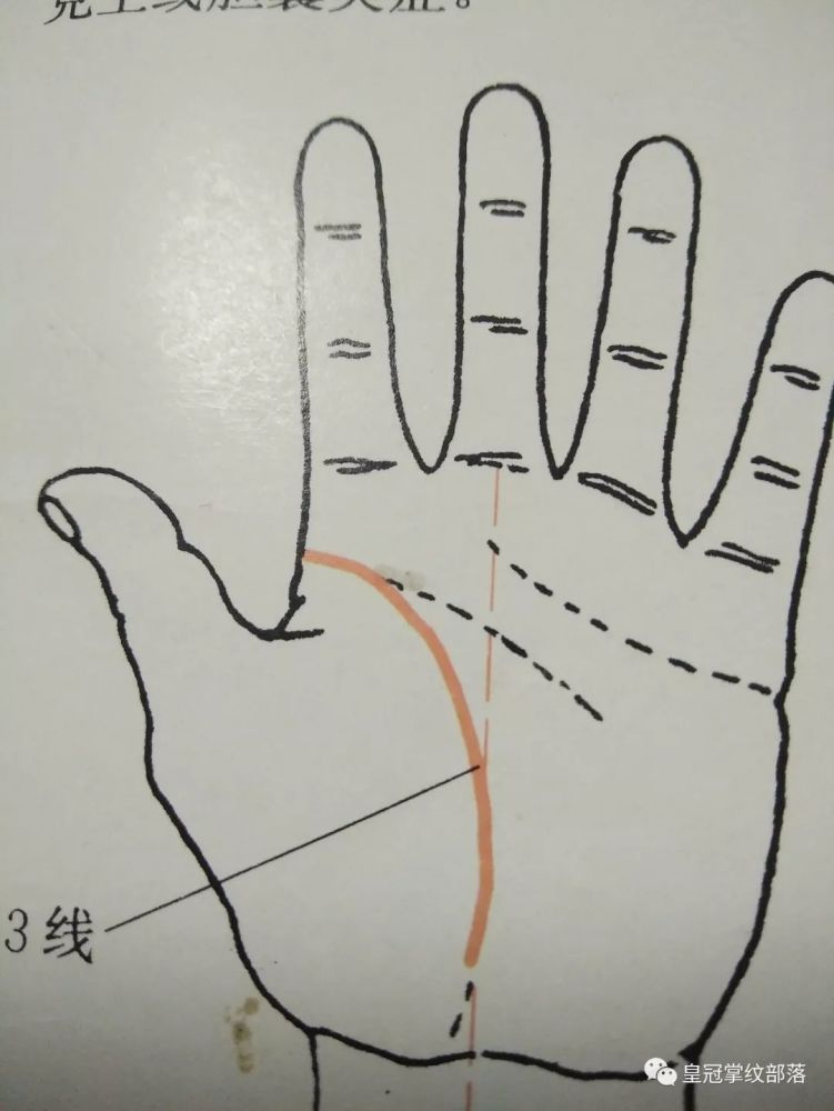 掌纹诊病—掌纹14条线